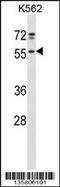 NFS1 Cysteine Desulfurase antibody, 58-465, ProSci, Western Blot image 