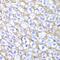 Major Histocompatibility Complex, Class I, A antibody, GTX54099, GeneTex, Immunohistochemistry paraffin image 