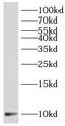 Selenoprotein K antibody, FNab07704, FineTest, Western Blot image 