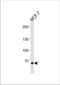 TSPY Like 2 antibody, TA325164, Origene, Western Blot image 