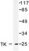 Thymidine Kinase 1 antibody, LS-C176475, Lifespan Biosciences, Western Blot image 