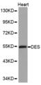 Desmin antibody, abx000834, Abbexa, Western Blot image 