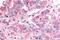 Serum/Glucocorticoid Regulated Kinase 2 antibody, NLS7221, Novus Biologicals, Immunohistochemistry paraffin image 