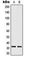 ELOVL Fatty Acid Elongase 1 antibody, orb224117, Biorbyt, Western Blot image 