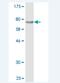 Phosphoglycerate Dehydrogenase antibody, H00026227-M02, Novus Biologicals, Western Blot image 