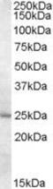 Methenyltetrahydrofolate Synthetase antibody, PA5-18925, Invitrogen Antibodies, Western Blot image 