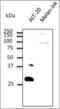 RAB27B, Member RAS Oncogene Family antibody, orb314754, Biorbyt, Western Blot image 