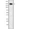 Ral GTPase Activating Protein Catalytic Alpha Subunit 1 antibody, abx218168, Abbexa, Western Blot image 