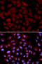 ACK1 antibody, 18-690, ProSci, Immunofluorescence image 