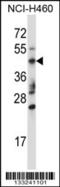 Tripartite motif-containing protein 15 antibody, 57-171, ProSci, Western Blot image 