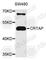 Cartilage Associated Protein antibody, A4428, ABclonal Technology, Western Blot image 