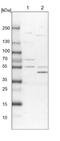 Aldehyde Dehydrogenase 6 Family Member A1 antibody, NBP1-82637, Novus Biologicals, Western Blot image 