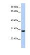 Claudin Domain Containing 1 antibody, NBP1-59441, Novus Biologicals, Western Blot image 