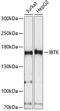 Inhibitor Of Bruton Tyrosine Kinase antibody, GTX66301, GeneTex, Western Blot image 