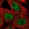 Glucosidase II Alpha Subunit antibody, NBP1-89806, Novus Biologicals, Immunocytochemistry image 