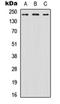 Kallikrein Related Peptidase 7 antibody, orb234887, Biorbyt, Western Blot image 