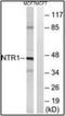 Neurotensin Receptor 1 antibody, orb94508, Biorbyt, Western Blot image 