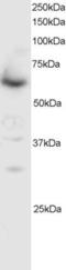 SMAD Family Member 4 antibody, orb18328, Biorbyt, Western Blot image 