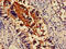 Actinin Alpha 4 antibody, CSB-PA00819A0Rb, Cusabio, Immunohistochemistry paraffin image 