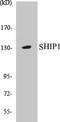 Inositol Polyphosphate-5-Phosphatase D antibody, EKC1520, Boster Biological Technology, Western Blot image 