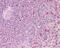 Suppression Of Tumorigenicity 5 antibody, 49-735, ProSci, Immunohistochemistry frozen image 