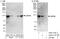 Zinc Finger Protein 148 antibody, A303-116A, Bethyl Labs, Immunoprecipitation image 