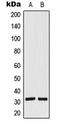 Siah E3 Ubiquitin Protein Ligase 1 antibody, LS-C354249, Lifespan Biosciences, Western Blot image 