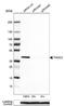 THO Complex 3 antibody, NBP1-92502, Novus Biologicals, Western Blot image 