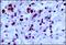 Egl-9 Family Hypoxia Inducible Factor 3 antibody, NB100-139, Novus Biologicals, Immunohistochemistry paraffin image 