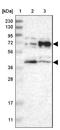 Butyrophilin Subfamily 2 Member A1 antibody, NBP1-88504, Novus Biologicals, Western Blot image 