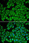 Interleukin 12 Receptor Subunit Beta 1 antibody, 14-916, ProSci, Immunofluorescence image 