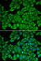 Interleukin 12 Receptor Subunit Beta 1 antibody, 14-916, ProSci, Immunofluorescence image 