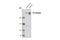 Inositol 1,4,5-Trisphosphate Receptor Type 1 antibody, 3763S, Cell Signaling Technology, Western Blot image 