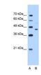 Creatine Kinase, Mitochondrial 2 antibody, NBP1-54661, Novus Biologicals, Western Blot image 