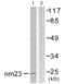 NME/NM23 Nucleoside Diphosphate Kinase 1 antibody, abx013155, Abbexa, Western Blot image 