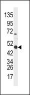 Aldehyde Dehydrogenase 3 Family Member A1 antibody, PA5-15004, Invitrogen Antibodies, Western Blot image 