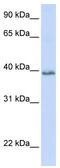 Tetraspanin-10 antibody, TA339592, Origene, Western Blot image 