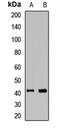 Interleukin 2 Receptor Subunit Gamma antibody, LS-C667756, Lifespan Biosciences, Western Blot image 