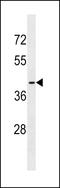 Olfactory Receptor Family 56 Subfamily B Member 1 antibody, LS-C158488, Lifespan Biosciences, Western Blot image 