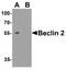 WW And C2 Domain Containing 1 antibody, A02837, Boster Biological Technology, Western Blot image 