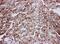 Solute Carrier Family 2 Member 4 antibody, PA5-80021, Invitrogen Antibodies, Immunohistochemistry paraffin image 