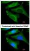 Interleukin 1 Receptor Antagonist antibody, NBP1-32568, Novus Biologicals, Immunofluorescence image 