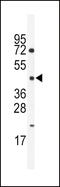 Hepatocyte Nuclear Factor 4 Gamma antibody, 62-922, ProSci, Western Blot image 