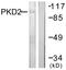 Protein Kinase D2 antibody, LS-B5654, Lifespan Biosciences, Western Blot image 