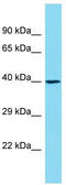 Olfactory Receptor Family 6 Subfamily C Member 1 antibody, TA334899, Origene, Western Blot image 