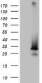 Sorting Nexin 10 antibody, M07395, Boster Biological Technology, Western Blot image 