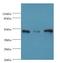 Succinyl-CoA:Glutarate-CoA Transferase antibody, LS-C379473, Lifespan Biosciences, Western Blot image 