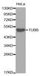 Tubulin Beta 1 Class VI antibody, abx005943, Abbexa, Western Blot image 