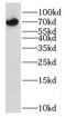 Interleukin 3 Receptor Subunit Alpha antibody, FNab04277, FineTest, Western Blot image 