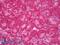 Alpha-1-antitrypsin antibody, LS-B7084, Lifespan Biosciences, Immunohistochemistry paraffin image 